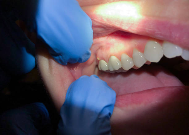 Best Dentist for Dental Trauma  in Hahnville, LA
