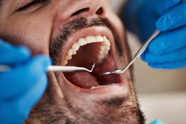 Best Cracked Tooth Emergency Dentist  in Hahnville, LA